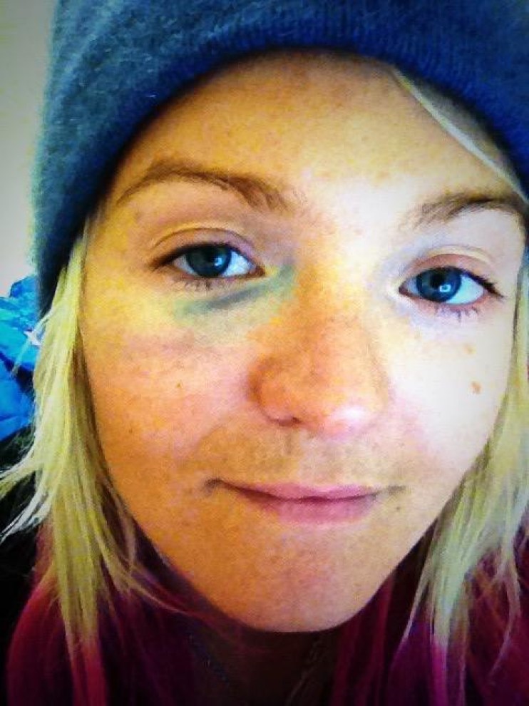 mercedessochifeb142014 Mercedes Nicoll deux jours après sa chute aux Jeux olympiques de Sotchi, le 14 février 2014.
